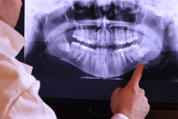 Best Emergency Treatment for Jaw Pain or Injury in Wilmington, DE