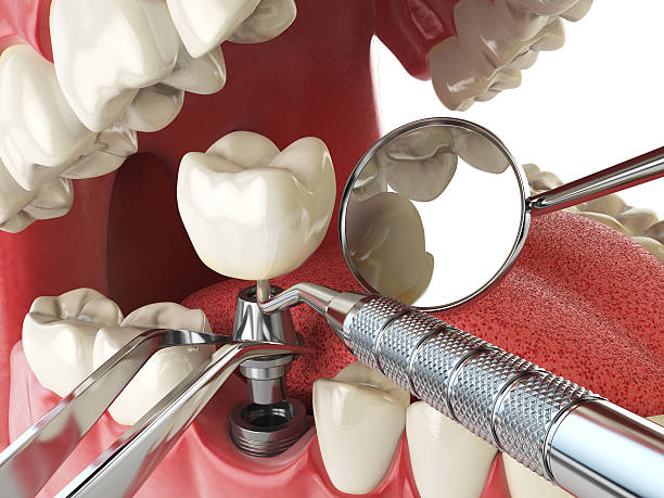 Professional Emergency Dental Service in DE